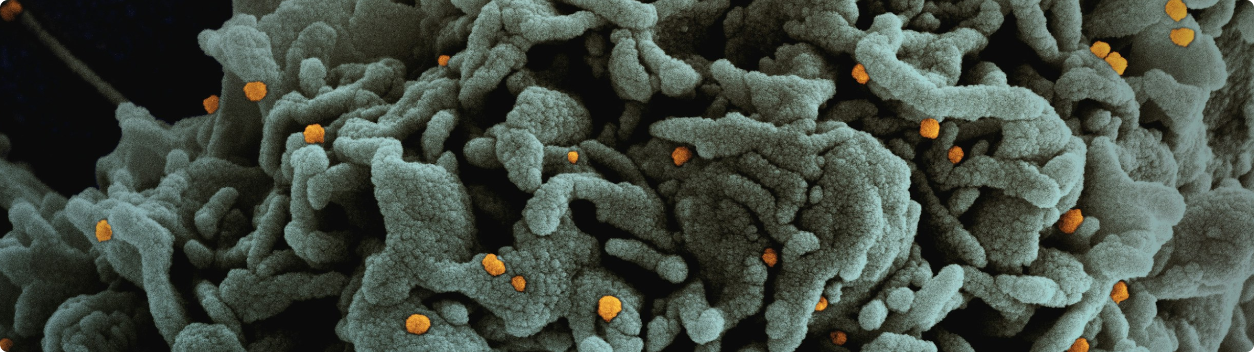 Paicon Accelerates Global Cancer Diagnostics with Vast.ai's High-Performance GPU Cloud